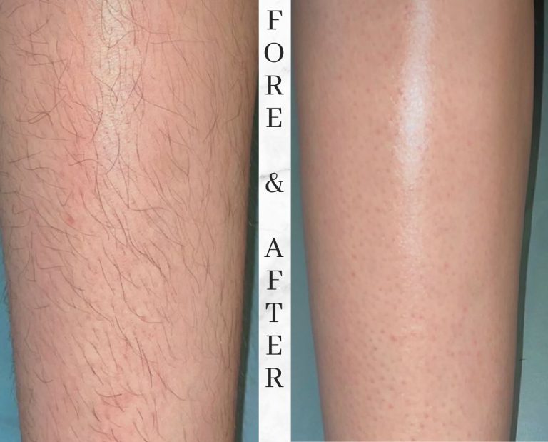 falcon4pro-before-after2