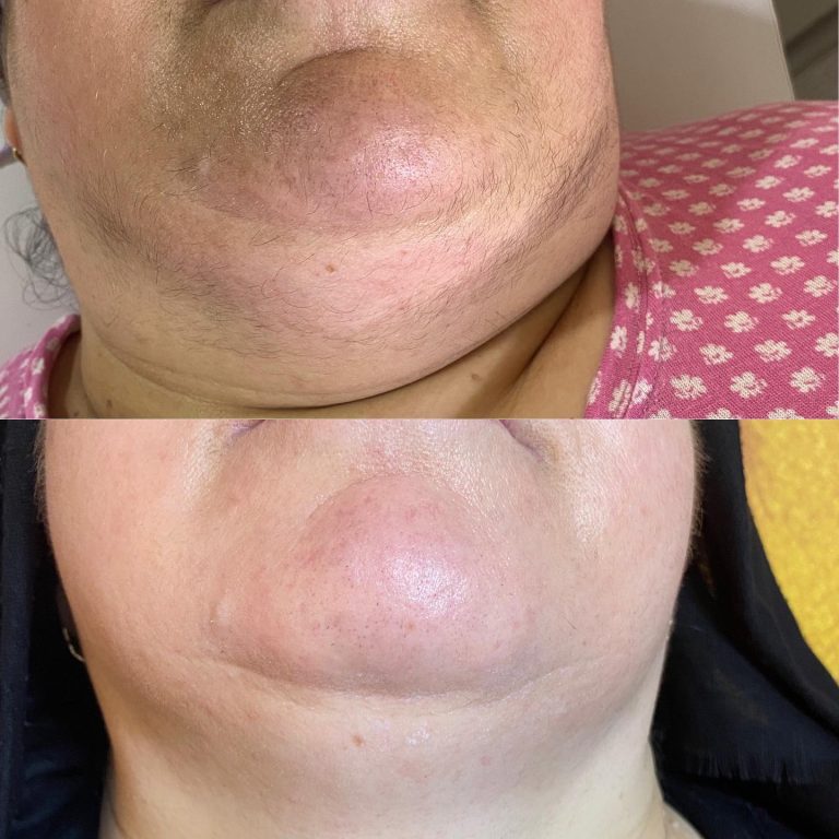 falcon4pro-before-after4