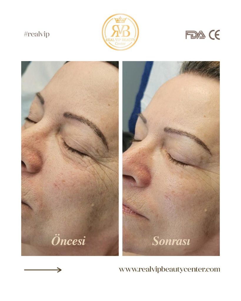 Bahçelievler Cilt Bakımı 